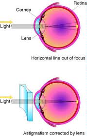 AstigmatismCorrection