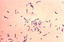 220px Corynebacterium diphtheriae Gram stain